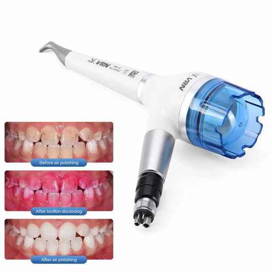 Prophy Jet " Dental Air Polisher "