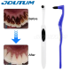 Tooth Stain Eraser – Home Use Or Tartar & Plaque Remover Tool
