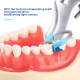 Sectional Matrix System – Contoured Bands with NiTi Ring Sectional Matrix System – Contoured Bands with NiTi Ring