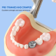 Primary Molar Stainless Steel Crowns