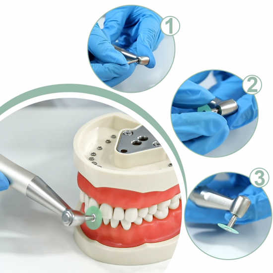 Dental Polishing Discs Dental Polishing Discs