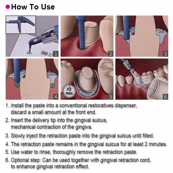 3M ESPE Astringent Retraction Paste 0.3g/pc 3M ESPE Astringent Retraction Paste 0.3g/pc