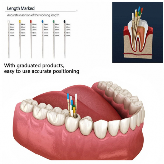 Dental Absorbent Paper Points Dental Absorbent Paper Points