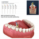 Dental Absorbent Paper Points Dental Absorbent Paper Points