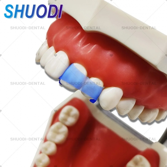 Butterfly Matrix System or Anterior Strip Matrix with Wedges