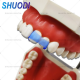 Butterfly Matrix System or Anterior Strip Matrix with Wedges