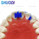 Butterfly Matrix System or Anterior Strip Matrix with Wedges