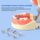 Stainless Steel Crowns Stainless Steel Crowns