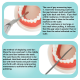 interproximal reduction system IPR 
