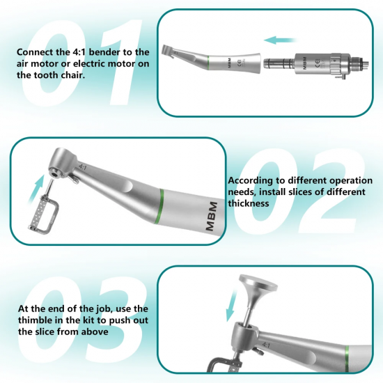 interproximal reduction system IPR 