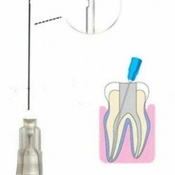 irrigation needle 2 side 27g 50pcs